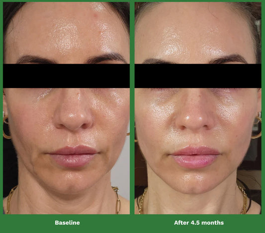 Adipeau Volume Cream