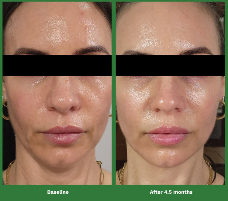 Adipeau Volume Cream